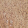 Travertine Scabas